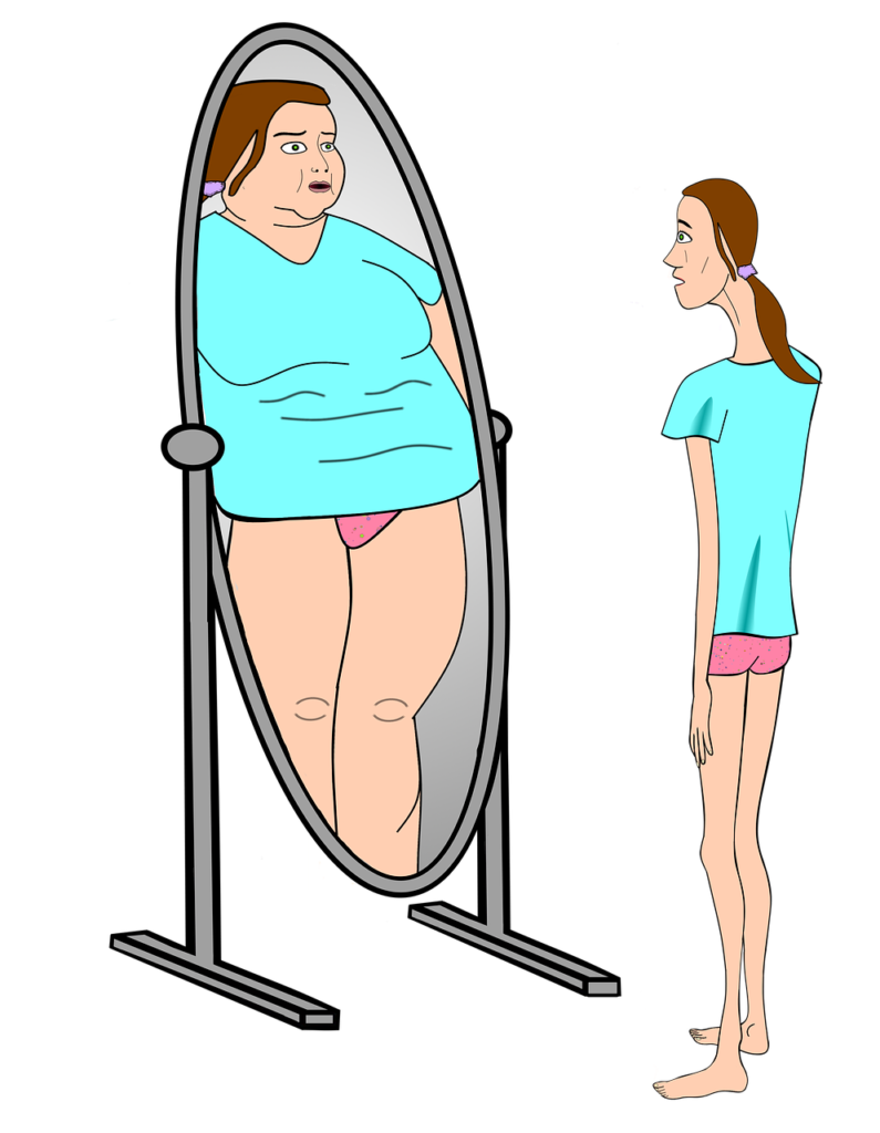 Mentálna anorexia (Anorexia nervosa) a jej príznaky: Dievča s podváhou vníma svoj odraz v zrkadle ako obézny.